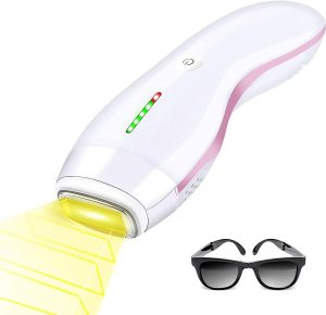 🌟 العرض الخاص - تخلص من الشعر بشكل دائم مع أجهزة الليزر الحديثة! 🌟