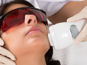 اختيار جهاز الليزر المناسب لإزالة الشعر: النقاط الأساسية لاختيار الخيار الأفضل